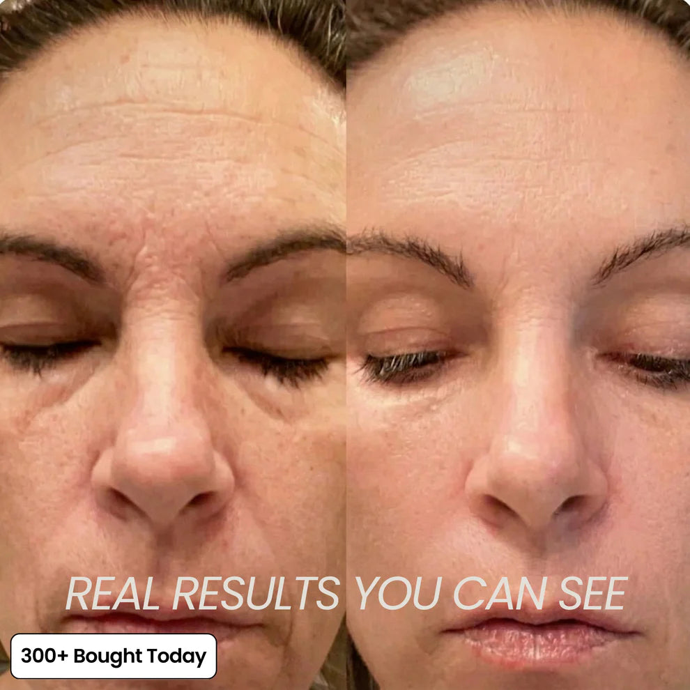 Transform Wrinkles, Fine Lines, And Tired Creases Naturally